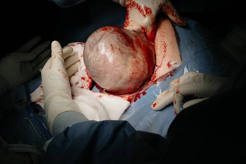 Fotografia de Parto - Newborn - Evelyn Moura Fotografia em Niterói, Rio de Janeiro - ensaio infantil - newborn de recém nascido - partos - parto em niteroi - registro de parto - maternidade são francisco - doce nascer - parto humanizado - andrea barbosa '