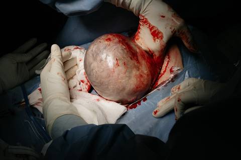 Fotografia de Parto - Newborn - Evelyn Moura Fotografia em Niterói, Rio de Janeiro - ensaio infantil - newborn de recém nascido - partos - parto em niteroi - registro de parto - maternidade são francisco - doce nascer - parto humanizado - andrea barbosa '