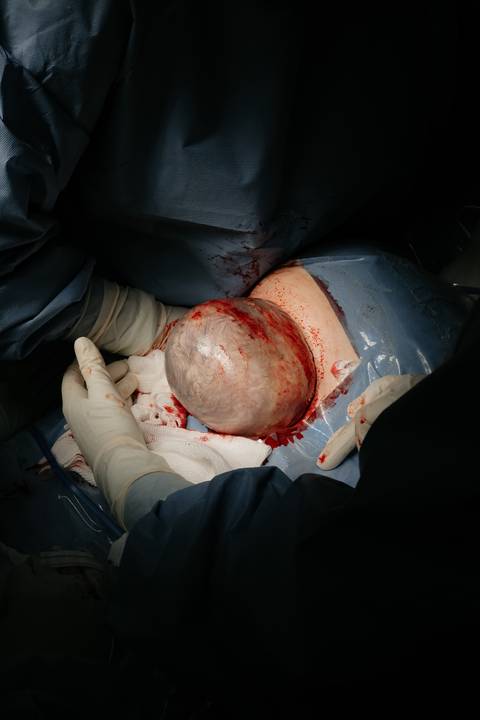 Fotografia de Parto - Newborn - Evelyn Moura Fotografia em Niterói, Rio de Janeiro - ensaio infantil - newborn de recém nascido - partos - parto em niteroi - registro de parto - maternidade são francisco - doce nascer - parto humanizado - andrea barbosa '