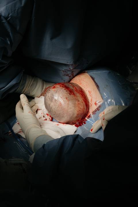 Fotografia de Parto - Newborn - Evelyn Moura Fotografia em Niterói, Rio de Janeiro - ensaio infantil - newborn de recém nascido - partos - parto em niteroi - registro de parto - maternidade são francisco - doce nascer - parto humanizado - andrea barbosa '