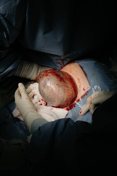 Fotografia de Parto - Newborn - Evelyn Moura Fotografia em Niterói, Rio de Janeiro - ensaio infantil - newborn de recém nascido - partos - parto em niteroi - registro de parto - maternidade são francisco - doce nascer - parto humanizado - andrea barbosa '