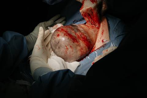 Fotografia de Parto - Newborn - Evelyn Moura Fotografia em Niterói, Rio de Janeiro - ensaio infantil - newborn de recém nascido - partos - parto em niteroi - registro de parto - maternidade são francisco - doce nascer - parto humanizado - andrea barbosa '