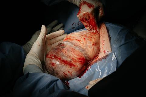 Fotografia de Parto - Newborn - Evelyn Moura Fotografia em Niterói, Rio de Janeiro - ensaio infantil - newborn de recém nascido - partos - parto em niteroi - registro de parto - maternidade são francisco - doce nascer - parto humanizado - andrea barbosa '