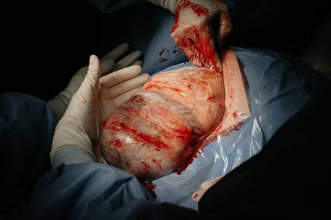 Fotografia de Parto - Newborn - Evelyn Moura Fotografia em Niterói, Rio de Janeiro - ensaio infantil - newborn de recém nascido - partos - parto em niteroi - registro de parto - maternidade são francisco - doce nascer - parto humanizado - andrea barbosa '