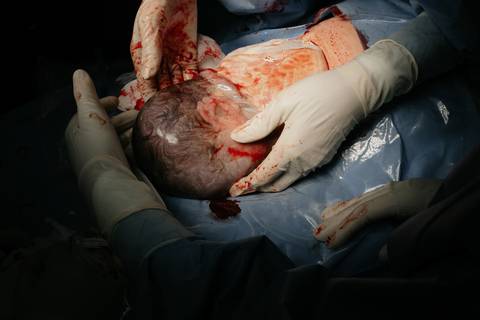 Fotografia de Parto - Newborn - Evelyn Moura Fotografia em Niterói, Rio de Janeiro - ensaio infantil - newborn de recém nascido - partos - parto em niteroi - registro de parto - maternidade são francisco - doce nascer - parto humanizado - andrea barbosa '