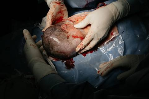 Fotografia de Parto - Newborn - Evelyn Moura Fotografia em Niterói, Rio de Janeiro - ensaio infantil - newborn de recém nascido - partos - parto em niteroi - registro de parto - maternidade são francisco - doce nascer - parto humanizado - andrea barbosa '