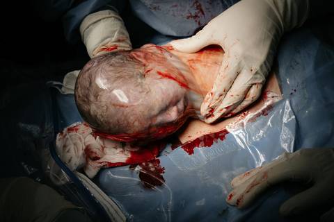 Fotografia de Parto - Newborn - Evelyn Moura Fotografia em Niterói, Rio de Janeiro - ensaio infantil - newborn de recém nascido - partos - parto em niteroi - registro de parto - maternidade são francisco - doce nascer - parto humanizado - andrea barbosa '