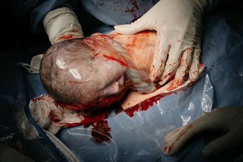 Fotografia de Parto - Newborn - Evelyn Moura Fotografia em Niterói, Rio de Janeiro - ensaio infantil - newborn de recém nascido - partos - parto em niteroi - registro de parto - maternidade são francisco - doce nascer - parto humanizado - andrea barbosa '