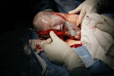 Fotografia de Parto - Newborn - Evelyn Moura Fotografia em Niterói, Rio de Janeiro - ensaio infantil - newborn de recém nascido - partos - parto em niteroi - registro de parto - maternidade são francisco - doce nascer - parto humanizado - andrea barbosa '