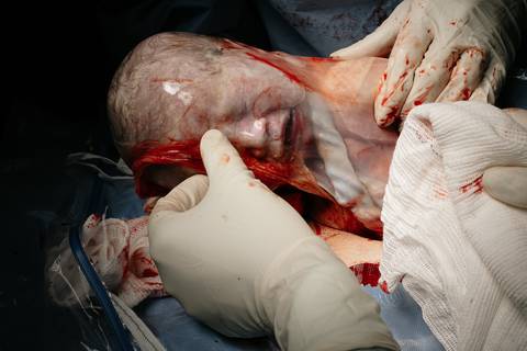 Fotografia de Parto - Newborn - Evelyn Moura Fotografia em Niterói, Rio de Janeiro - ensaio infantil - newborn de recém nascido - partos - parto em niteroi - registro de parto - maternidade são francisco - doce nascer - parto humanizado - andrea barbosa '