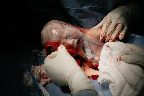 Fotografia de Parto - Newborn - Evelyn Moura Fotografia em Niterói, Rio de Janeiro - ensaio infantil - newborn de recém nascido - partos - parto em niteroi - registro de parto - maternidade são francisco - doce nascer - parto humanizado - andrea barbosa '