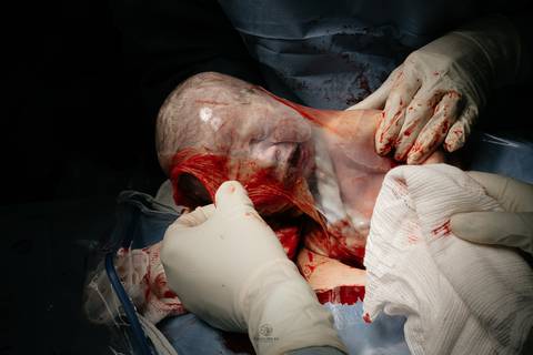 Fotografia de Parto - Newborn - Evelyn Moura Fotografia em Niterói, Rio de Janeiro - ensaio infantil - newborn de recém nascido - partos - parto em niteroi - registro de parto - maternidade são francisco - doce nascer - parto humanizado - andrea barbosa '