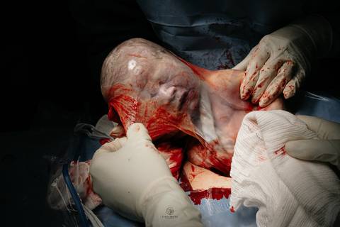 Fotografia de Parto - Newborn - Evelyn Moura Fotografia em Niterói, Rio de Janeiro - ensaio infantil - newborn de recém nascido - partos - parto em niteroi - registro de parto - maternidade são francisco - doce nascer - parto humanizado - andrea barbosa '