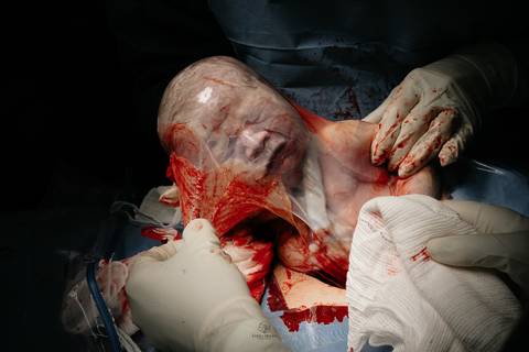 Fotografia de Parto - Newborn - Evelyn Moura Fotografia em Niterói, Rio de Janeiro - ensaio infantil - newborn de recém nascido - partos - parto em niteroi - registro de parto - maternidade são francisco - doce nascer - parto humanizado - andrea barbosa '