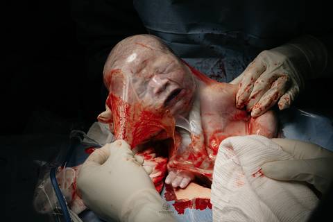 Fotografia de Parto - Newborn - Evelyn Moura Fotografia em Niterói, Rio de Janeiro - ensaio infantil - newborn de recém nascido - partos - parto em niteroi - registro de parto - maternidade são francisco - doce nascer - parto humanizado - andrea barbosa '