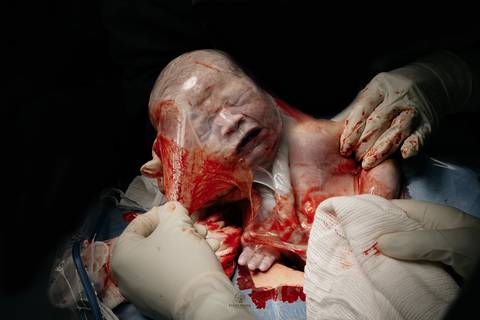 Fotografia de Parto - Newborn - Evelyn Moura Fotografia em Niterói, Rio de Janeiro - ensaio infantil - newborn de recém nascido - partos - parto em niteroi - registro de parto - maternidade são francisco - doce nascer - parto humanizado - andrea barbosa '