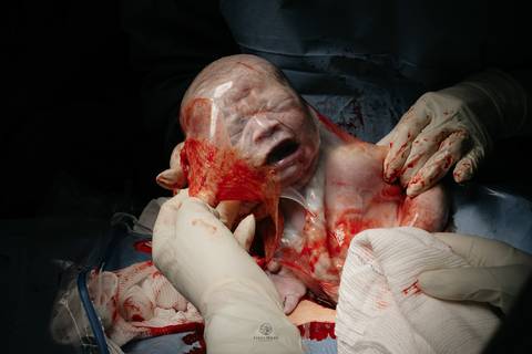 Fotografia de Parto - Newborn - Evelyn Moura Fotografia em Niterói, Rio de Janeiro - ensaio infantil - newborn de recém nascido - partos - parto em niteroi - registro de parto - maternidade são francisco - doce nascer - parto humanizado - andrea barbosa '