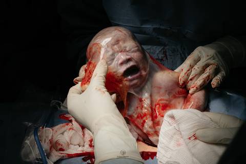 Fotografia de Parto - Newborn - Evelyn Moura Fotografia em Niterói, Rio de Janeiro - ensaio infantil - newborn de recém nascido - partos - parto em niteroi - registro de parto - maternidade são francisco - doce nascer - parto humanizado - andrea barbosa '