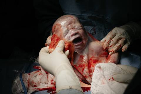 Fotografia de Parto - Newborn - Evelyn Moura Fotografia em Niterói, Rio de Janeiro - ensaio infantil - newborn de recém nascido - partos - parto em niteroi - registro de parto - maternidade são francisco - doce nascer - parto humanizado - andrea barbosa '