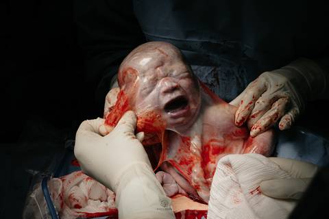 Fotografia de Parto - Newborn - Evelyn Moura Fotografia em Niterói, Rio de Janeiro - ensaio infantil - newborn de recém nascido - partos - parto em niteroi - registro de parto - maternidade são francisco - doce nascer - parto humanizado - andrea barbosa '