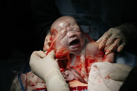 Fotografia de Parto - Newborn - Evelyn Moura Fotografia em Niterói, Rio de Janeiro - ensaio infantil - newborn de recém nascido - partos - parto em niteroi - registro de parto - maternidade são francisco - doce nascer - parto humanizado - andrea barbosa '