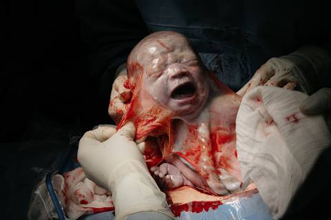 Fotografia de Parto - Newborn - Evelyn Moura Fotografia em Niterói, Rio de Janeiro - ensaio infantil - newborn de recém nascido - partos - parto em niteroi - registro de parto - maternidade são francisco - doce nascer - parto humanizado - andrea barbosa '