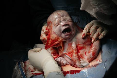 Fotografia de Parto - Newborn - Evelyn Moura Fotografia em Niterói, Rio de Janeiro - ensaio infantil - newborn de recém nascido - partos - parto em niteroi - registro de parto - maternidade são francisco - doce nascer - parto humanizado - andrea barbosa '