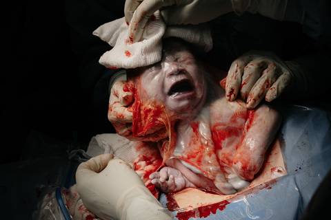 Fotografia de Parto - Newborn - Evelyn Moura Fotografia em Niterói, Rio de Janeiro - ensaio infantil - newborn de recém nascido - partos - parto em niteroi - registro de parto - maternidade são francisco - doce nascer - parto humanizado - andrea barbosa '