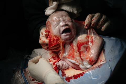 Fotografia de Parto - Newborn - Evelyn Moura Fotografia em Niterói, Rio de Janeiro - ensaio infantil - newborn de recém nascido - partos - parto em niteroi - registro de parto - maternidade são francisco - doce nascer - parto humanizado - andrea barbosa '