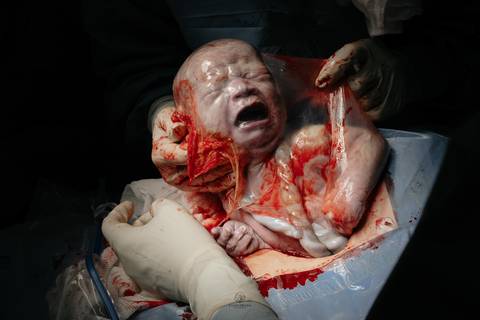 Fotografia de Parto - Newborn - Evelyn Moura Fotografia em Niterói, Rio de Janeiro - ensaio infantil - newborn de recém nascido - partos - parto em niteroi - registro de parto - maternidade são francisco - doce nascer - parto humanizado - andrea barbosa '