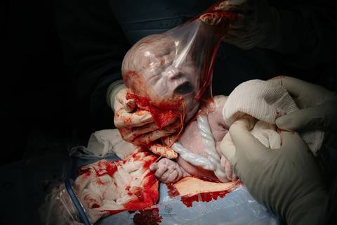 Fotografia de Parto - Newborn - Evelyn Moura Fotografia em Niterói, Rio de Janeiro - ensaio infantil - newborn de recém nascido - partos - parto em niteroi - registro de parto - maternidade são francisco - doce nascer - parto humanizado - andrea barbosa '