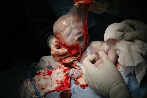 Fotografia de Parto - Newborn - Evelyn Moura Fotografia em Niterói, Rio de Janeiro - ensaio infantil - newborn de recém nascido - partos - parto em niteroi - registro de parto - maternidade são francisco - doce nascer - parto humanizado - andrea barbosa '