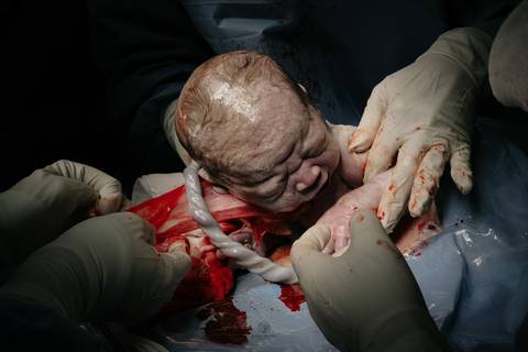 Fotografia de Parto - Newborn - Evelyn Moura Fotografia em Niterói, Rio de Janeiro - ensaio infantil - newborn de recém nascido - partos - parto em niteroi - registro de parto - maternidade são francisco - doce nascer - parto humanizado - andrea barbosa '