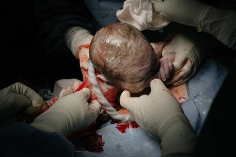 Fotografia de Parto - Newborn - Evelyn Moura Fotografia em Niterói, Rio de Janeiro - ensaio infantil - newborn de recém nascido - partos - parto em niteroi - registro de parto - maternidade são francisco - doce nascer - parto humanizado - andrea barbosa '