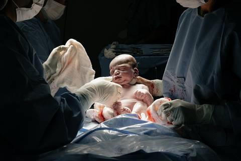 Fotografia de Parto - Newborn - Evelyn Moura Fotografia em Niterói, Rio de Janeiro - ensaio infantil - newborn de recém nascido - partos - parto em niteroi - registro de parto - maternidade são francisco - doce nascer - parto humanizado - andrea barbosa '