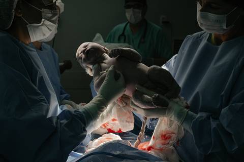 Fotografia de Parto - Newborn - Evelyn Moura Fotografia em Niterói, Rio de Janeiro - ensaio infantil - newborn de recém nascido - partos - parto em niteroi - registro de parto - maternidade são francisco - doce nascer - parto humanizado - andrea barbosa '