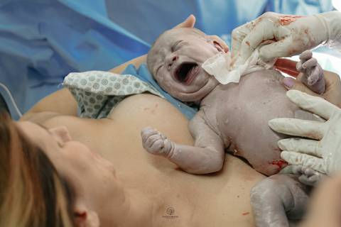 Fotografia de Parto - Newborn - Evelyn Moura Fotografia em Niterói, Rio de Janeiro - ensaio infantil - newborn de recém nascido - partos - parto em niteroi - registro de parto - maternidade são francisco - doce nascer - parto humanizado - andrea barbosa '