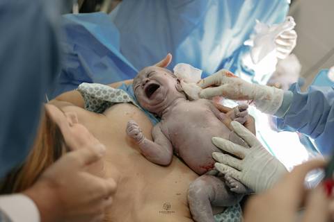 Fotografia de Parto - Newborn - Evelyn Moura Fotografia em Niterói, Rio de Janeiro - ensaio infantil - newborn de recém nascido - partos - parto em niteroi - registro de parto - maternidade são francisco - doce nascer - parto humanizado - andrea barbosa '