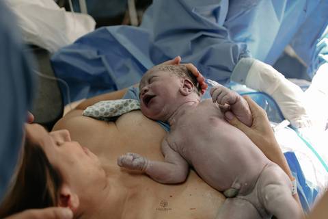 Fotografia de Parto - Newborn - Evelyn Moura Fotografia em Niterói, Rio de Janeiro - ensaio infantil - newborn de recém nascido - partos - parto em niteroi - registro de parto - maternidade são francisco - doce nascer - parto humanizado - andrea barbosa '