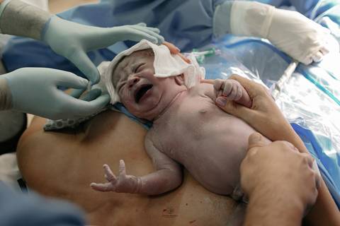 Fotografia de Parto - Newborn - Evelyn Moura Fotografia em Niterói, Rio de Janeiro - ensaio infantil - newborn de recém nascido - partos - parto em niteroi - registro de parto - maternidade são francisco - doce nascer - parto humanizado - andrea barbosa '
