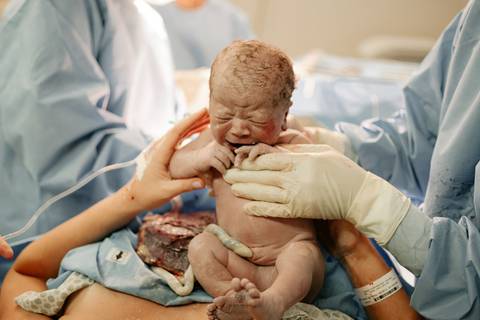 Fotografia de Parto - Newborn - Evelyn Moura Fotografia em Niterói, Rio de Janeiro - ensaio infantil - newborn de recém nascido - partos - parto em niteroi - registro de parto - maternidade são francisco - doce nascer - parto humanizado - andrea barbosa '