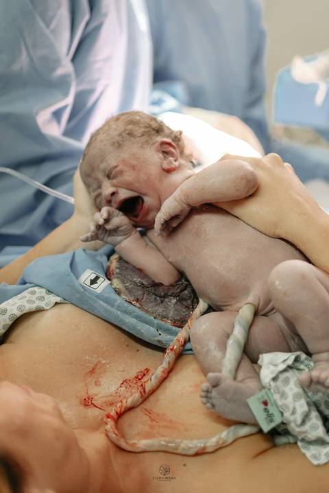 Fotografia de Parto - Newborn - Evelyn Moura Fotografia em Niterói, Rio de Janeiro - ensaio infantil - newborn de recém nascido - partos - parto em niteroi - registro de parto - maternidade são francisco - doce nascer - parto humanizado - andrea barbosa '