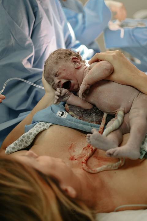 Fotografia de Parto - Newborn - Evelyn Moura Fotografia em Niterói, Rio de Janeiro - ensaio infantil - newborn de recém nascido - partos - parto em niteroi - registro de parto - maternidade são francisco - doce nascer - parto humanizado - andrea barbosa '