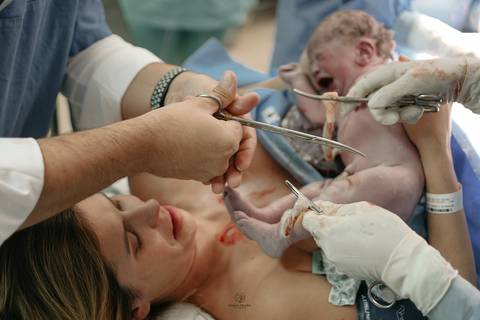 Fotografia de Parto - Newborn - Evelyn Moura Fotografia em Niterói, Rio de Janeiro - ensaio infantil - newborn de recém nascido - partos - parto em niteroi - registro de parto - maternidade são francisco - doce nascer - parto humanizado - andrea barbosa '