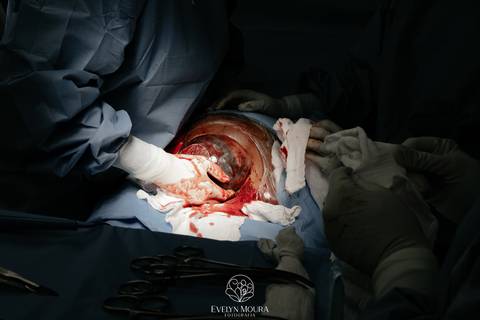 Fotografia de Parto - Newborn - Evelyn Moura Fotografia em Niterói, Rio de Janeiro - ensaio infantil - newborn de recém nascido - partos - parto em niteroi - registro de parto - maternidade são francisco - doce nascer - parto humanizado - andrea barbosa '