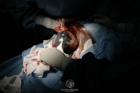 Fotografia de Parto - Newborn - Evelyn Moura Fotografia em Niterói, Rio de Janeiro - ensaio infantil - newborn de recém nascido - partos - parto em niteroi - registro de parto - maternidade são francisco - doce nascer - parto humanizado - andrea barbosa '