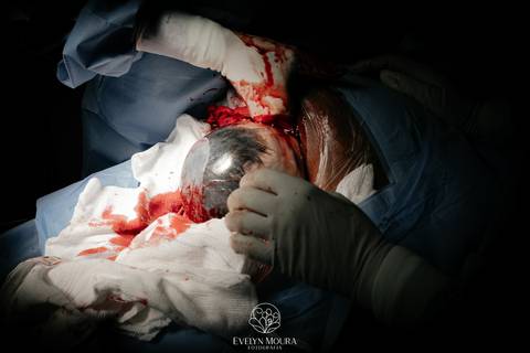 Fotografia de Parto - Newborn - Evelyn Moura Fotografia em Niterói, Rio de Janeiro - ensaio infantil - newborn de recém nascido - partos - parto em niteroi - registro de parto - maternidade são francisco - doce nascer - parto humanizado - andrea barbosa '