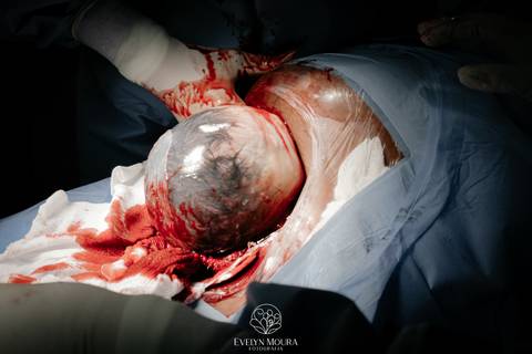 Fotografia de Parto - Newborn - Evelyn Moura Fotografia em Niterói, Rio de Janeiro - ensaio infantil - newborn de recém nascido - partos - parto em niteroi - registro de parto - maternidade são francisco - doce nascer - parto humanizado - andrea barbosa '