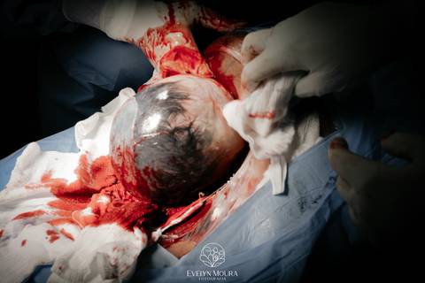 Fotografia de Parto - Newborn - Evelyn Moura Fotografia em Niterói, Rio de Janeiro - ensaio infantil - newborn de recém nascido - partos - parto em niteroi - registro de parto - maternidade são francisco - doce nascer - parto humanizado - andrea barbosa '