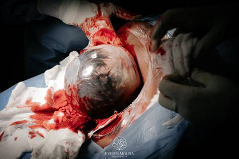 Fotografia de Parto - Newborn - Evelyn Moura Fotografia em Niterói, Rio de Janeiro - ensaio infantil - newborn de recém nascido - partos - parto em niteroi - registro de parto - maternidade são francisco - doce nascer - parto humanizado - andrea barbosa '